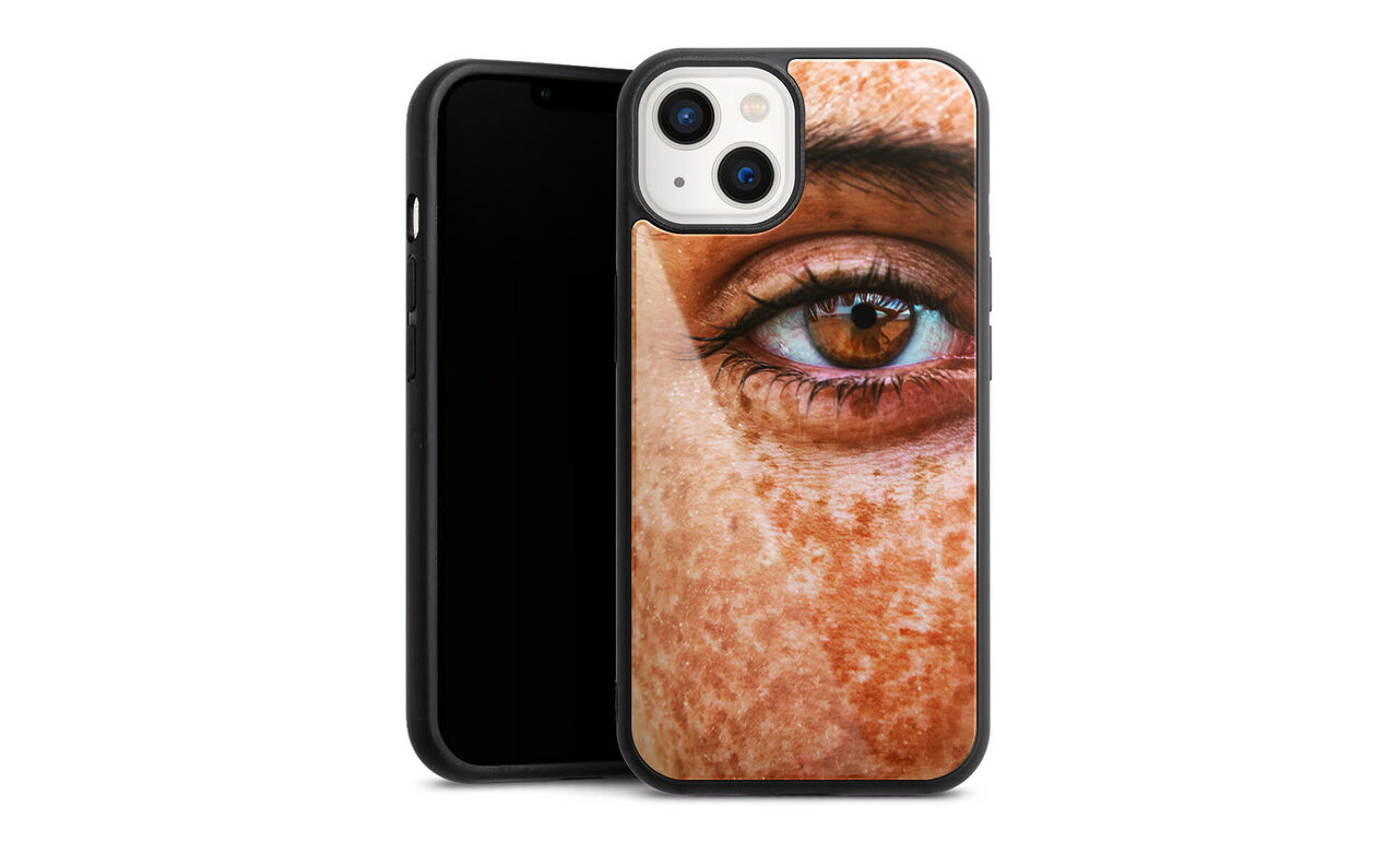 Funda de teléfono con un ojo y pecas en la parte delantera